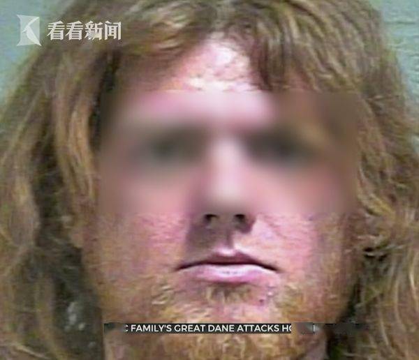 被狗咬的犯人